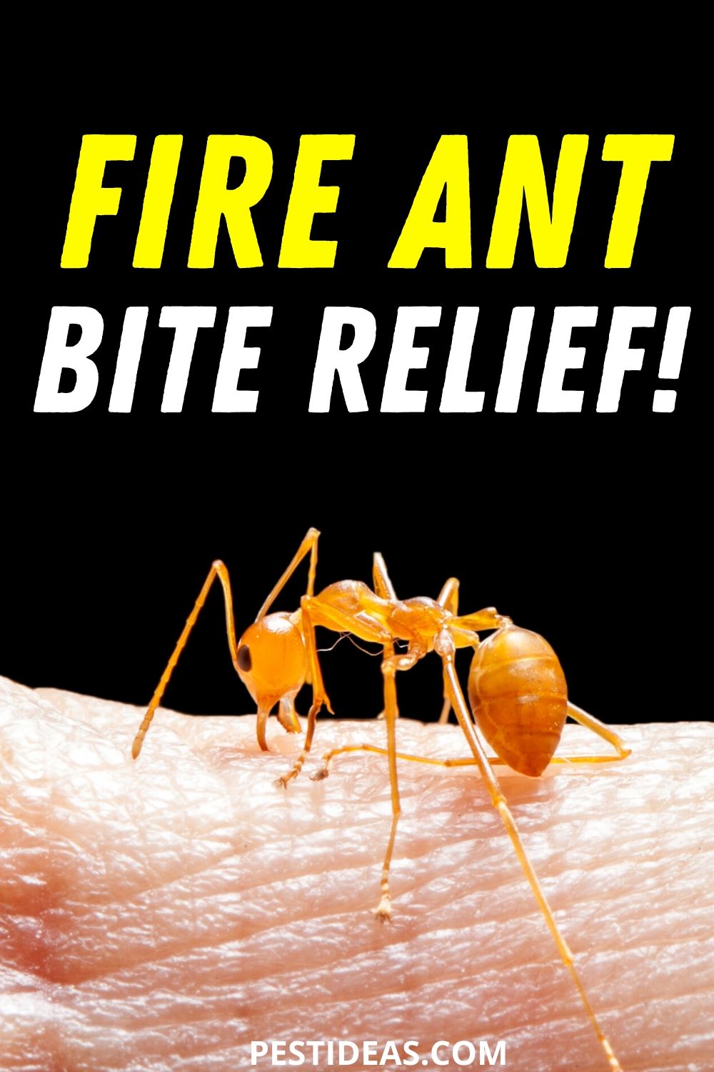 treat fire ant bites