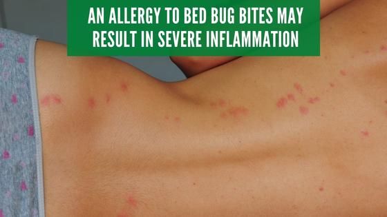 bed bug bite inflammation