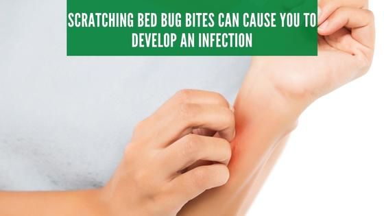 scratching bed bug bites can lead to infection